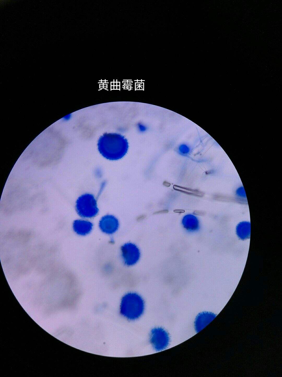 乳酸酚棉藍染色法